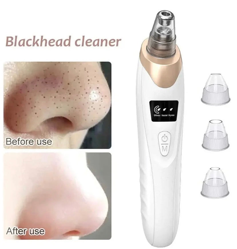 Black Heads Removal