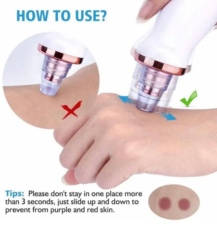 Black Heads Removal